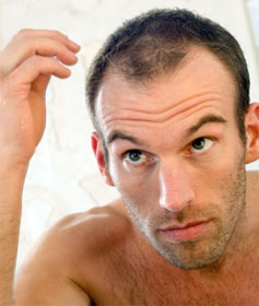 Balding man