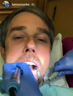 Beto O'Rourke at the dentist