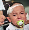 Sick Chinese baby