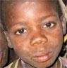 Starving child