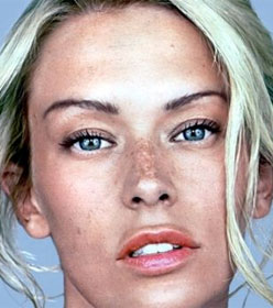 Young woman with sun damage